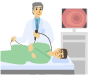 潰瘍性大腸炎の検査：内視鏡検査